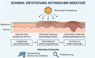 Aktinische Keratose – Vorstufe von Hautkrebs erkennen, verstehen und richtig einordnen